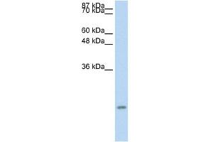 Western Blot showing CCL13 antibody used at a concentration of 1-2 ug/ml to detect its target protein. (CCL13 Antikörper  (Middle Region))