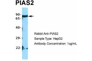 Host:  Rabbit  Target Name:  PIAS2  Sample Type:  HepG2  Antibody Dilution:  1.