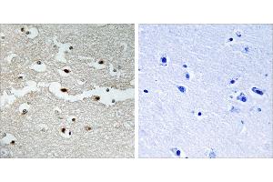 Peptide - +Immunohistochemistry analysis of paraffin-embedded human brain tissue, using BRCA2 antibody. (BRCA2 Antikörper)
