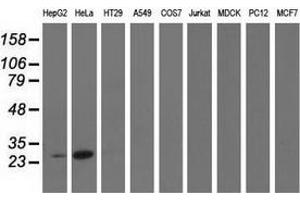 Western blot analysis of extracts (35 µg) from 9 different cell lines by using anti-GSTT2 monoclonal antibody. (GSTT2 Antikörper)
