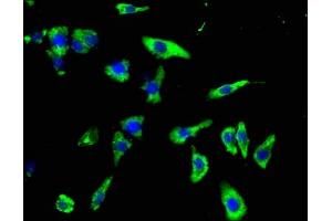 Immunofluorescence staining of HepG2 cells with ABIN7154398 at 1:100, counter-stained with DAPI. (CSF3R Antikörper  (AA 117-337))