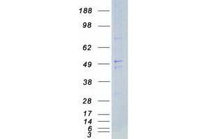 Western Blotting (WB) image for FYN Oncogene Related To SRC, FGR, YES (FYN) (Transcript Variant 3) protein (Myc-DYKDDDDK Tag) (ABIN2721480)