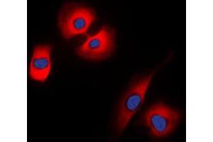 Immunofluorescent analysis of Synaptophysin staining in HeLa cells. (Synaptophysin Antikörper  (Center))