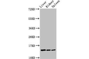 Western Blot Positive WB detected in: Rat liver tissue, Rat kidney tissue, Rat spleen tissue All lanes: CCDC26 antibody at 2. (CCDC26 Antikörper  (AA 1-109))