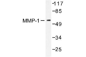 Image no. 1 for anti-Matrix Metallopeptidase 1 (Interstitial Collagenase) (MMP1) antibody (ABIN265522) (MMP1 Antikörper)