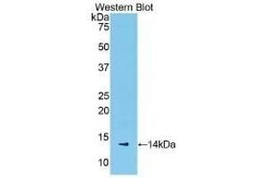 Detection of Recombinant SAA, Mouse using Polyclonal Antibody to Serum Amyloid A (SAA) (SAA Antikörper  (AA 20-122))