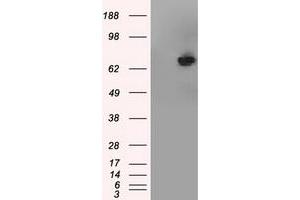 HEK293T cells were transfected with the pCMV6-ENTRY control (Left lane) or pCMV6-ENTRY TTLL12 (Right lane) cDNA for 48 hrs and lysed. (TTLL12 Antikörper)