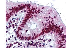 Anti-HNRNPK / hnRNP K antibody IHC of human colon. (HNRNPK Antikörper)
