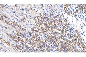 Detection of GPC1 in Mouse Kidney Tissue using Polyclonal Antibody to Glypican 1 (GPC1) (GPC1 Antikörper  (AA 155-292))