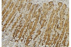 ABIN6277594 at 1/100 staining Human gastric tissue by IHC-P. (GALNS Antikörper  (Internal Region))