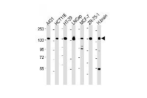 All lanes : Anti-MYO6 Antibody (C-term ) at 1:2000-1:8000 dilution Lane 1: A431 whole cell lysate Lane 2: HC whole cell lysate Lane 3: HT-29 whole cell lysate Lane 4: LNCap whole cell lysate Lane 5: MCF-7 whole cell lysate Lane 6: ZR-75-1 whole cell lysate Lane 7: Human brain lysate Lysates/proteins at 20 μg per lane. (Myosin VI Antikörper  (C-Term))