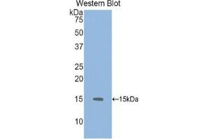 Western blot analysis of the recombinant protein. (GDF6 Antikörper  (AA 339-454))