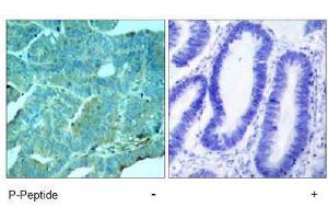 Image no. 1 for anti-Eukaryotic Translation Initiation Factor 2-alpha Kinase 2 (EIF2AK2) (pThr446) antibody (ABIN197048) (EIF2AK2 Antikörper  (pThr446))