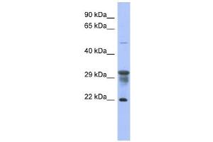 PMM1 antibody used at 1 ug/ml to detect target protein. (PMM1 Antikörper  (N-Term))