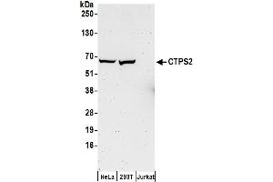 anti-CTP Synthase II (CTPS2) (AA 536-586) antibody