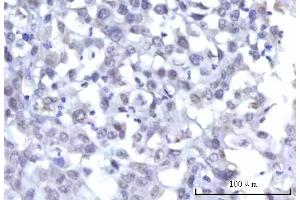IHC analysis of RBM15B using anti-RBM15B antibody (ABIN7600219).