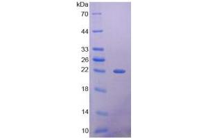 Image no. 1 for Histone Deacetylase 4 (HDAC4) (AA 904-1076) protein (His tag) (ABIN6237373)