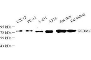 Western blot analysis of GSDMC (ABIN7074590) at dilution of 1: 50 (MLZE Antikörper)