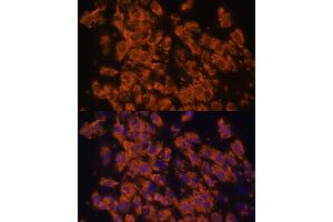 Immunofluorescence analysis of C6 cells using LRRC7 antibody (ABIN6128203, ABIN6143347, ABIN6143348 and ABIN6216986) at dilution of 1:100. (LRRC7 Antikörper  (AA 730-890))