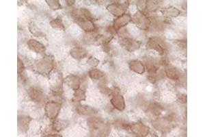 Immunohistochemical staining of pan synuclein in rat cochlear nucleus using Synuclein (pan) polyclonal antibody . (Synuclein Antikörper)