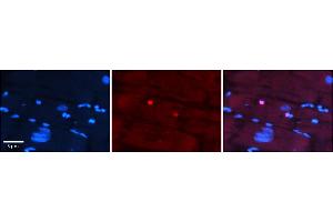 Rabbit Anti-IKZF4 Antibody    Formalin Fixed Paraffin Embedded Tissue: Human Adult heart  Observed Staining: Nuclear Primary Antibody Concentration: 1:100 Secondary Antibody: Donkey anti-Rabbit-Cy2/3 Secondary Antibody Concentration: 1:200 Magnification: 20X Exposure Time: 0.