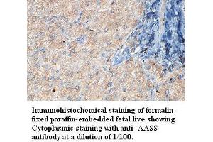 Image no. 1 for anti-Aminoadipate Semialdehyde Synthase (AASS) antibody (ABIN1574369) (AASS Antikörper)