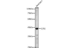 Western blot analysis of extracts of R. (CCR2 Antikörper  (AA 315-374))