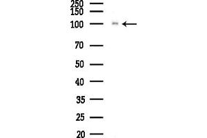 anti-Ataxin 2-Like (ATXN2L) (Internal Region) antibody