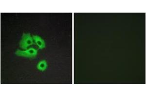 Immunofluorescence analysis of COS7 cells, using CCBP2 Antibody. (CCBP2 Antikörper  (AA 335-384))
