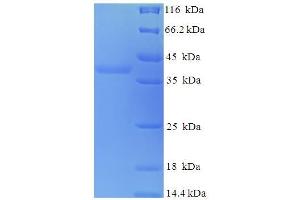 SDS-PAGE (SDS) image for Myelin Expression Factor 2 (MYEF2) (AA 372-576), (partial) protein (His-SUMO Tag) (ABIN5709985)