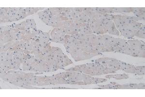 Immunohistochemistry (IHC) image for anti-Tumor Necrosis Factor-Inducible Protein 6 (TNFAIP6) (AA 18-275) antibody (ABIN7430159)