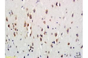 Formalin-fixed and paraffin embedded rat brain labeled with Anti-G-CSFR/CD114 Polyclonal Antibody, Unconjugated (ABIN742275) at 1:600 followed by conjugation to the secondary antibody and DAB staining (CSF3R Antikörper  (AA 101-200))