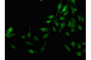 Immunofluorescence staining of Hela cells with ABIN7157162 at 1:133, counter-stained with DAPI. (JMY Antikörper  (AA 708-848))