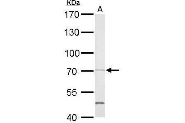 PTPN11 Antikörper  (C-Term)