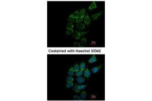 ICC/IF Image Immunofluorescence analysis of methanol-fixed Hep3B, using SIAT4A, antibody at 1:500 dilution. (ST3GAL1 Antikörper)