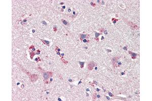 Anti-nNOS / NOS1 antibody IHC of human brain, cortex.