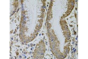 Immunohistochemistry of paraffin-embedded Human stomach using MTIF3 Polyclonal Antibody at dilution of 1:100 (40x lens).