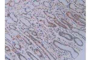 IHC-P analysis of Human Stomach Tissue, with DAB staining. (PEBP1 Antikörper  (AA 2-187))