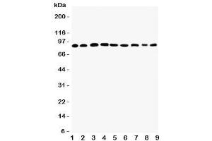 Western blot testing of Plakophilin 2 antibody and Lane 1:  rat heart (Plakophilin 2 Antikörper  (C-Term))