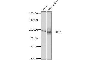 Western blot analysis of extracts of various cell lines using RIPK4 Polyclonal Antibody at dilution of 1:1000. (RIPK4 Antikörper)