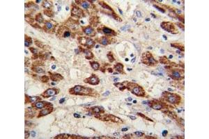 Immunohistochemistry (IHC) image for anti-Matrix Metallopeptidase 3 (Stromelysin 1, Progelatinase) (MMP3) (AA 298-327) antibody (ABIN3031719)
