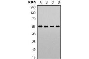 Western blot analysis of Alpha-1A Adrenergic Receptor expression in LOVO (A), Jurkat (B), NIH3T3 (C), PC12 (D) whole cell lysates.