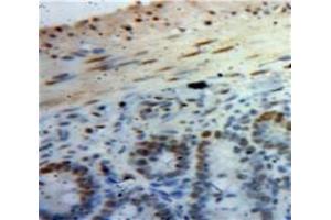 IHC-P analysis of Bowels tissue, with DAB staining. (HMGA1 Antikörper  (AA 3-107))