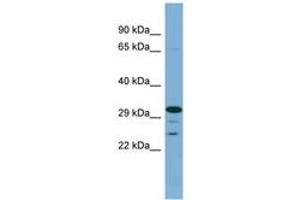 Image no. 1 for anti-Dehydrogenase/reductase (SDR Family) Member 9 (DHRS9) (AA 215-264) antibody (ABIN6741830) (DHRS9 Antikörper  (AA 215-264))