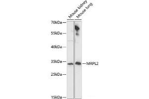 Western blot analysis of extracts of various cell lines using MRPL2 Polyclonal Antibody at dilution of 1:1000.