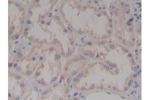 Immunohistochemistry (IHC) image for anti-Nephrosis 1, Congenital, Finnish Type (Nephrin) (NPHS1) (AA 23-92) antibody (ABIN7432916)