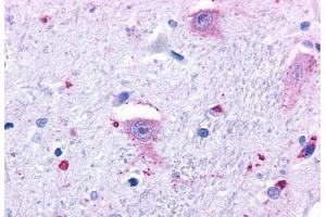 Anti-GPR37 antibody  ABIN1048809 IHC staining of human brain, neurons and glia. (GPR37 Antikörper  (N-Term))