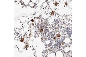 Immunohistochemical staining of human bone marrow with MTMR11 polyclonal antibody  shows strong cytoplasmic positivity in megakaryocytes.
