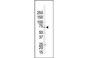 Western blot analysis of anti-GRK4 Pab (ABIN1882085 and ABIN2841170) in HL60 cell lysate. (GRK4 Antikörper  (C-Term))