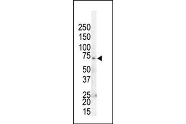 GRK4 Antikörper  (C-Term)